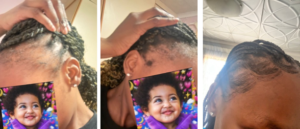 Before and After 1