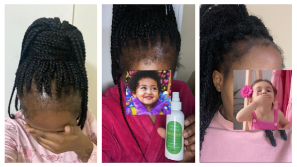 Before and After 2